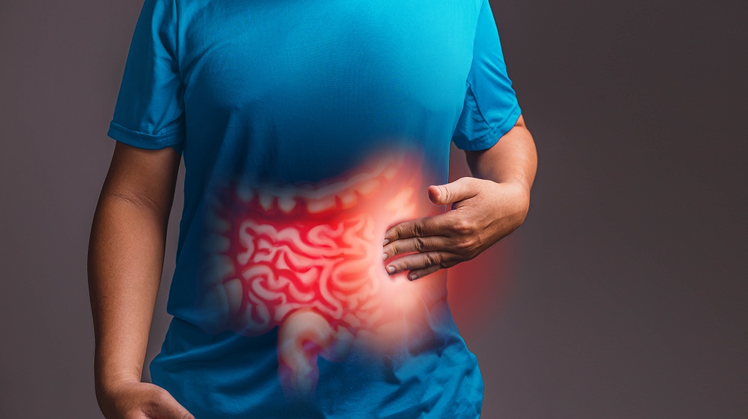 Cáncer de colon: un enemigo silencioso