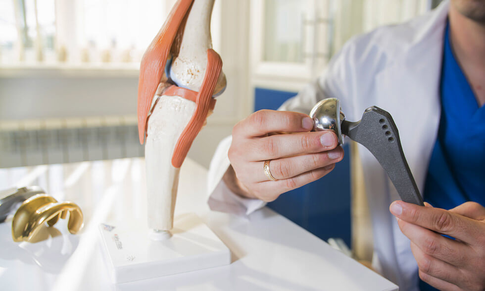 Hablemos de reemplazos articulares: ¿Qué son?, causas más comunes de desgaste de una articulación, medidas de prevención de un desgaste acelerado.