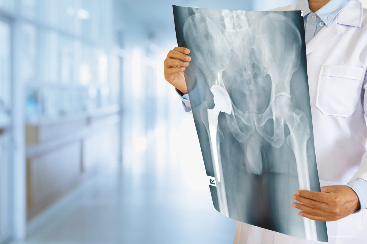 Hip surgery