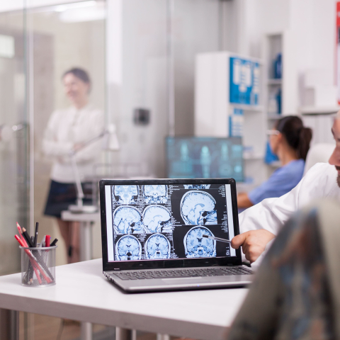 neurología_epilepsia