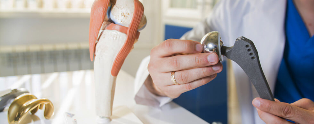 Let's talk about joint replacements: what are they?, most common causes of joint wear, measures to prevent accelerated wear.