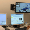 Conoce sobre la radiocirugía cerebral y sus beneficios