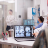 neurología_epilepsia